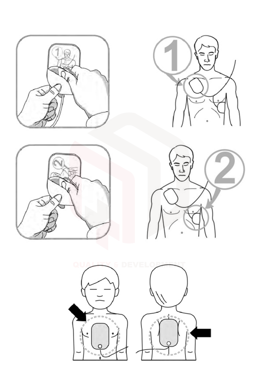 Hướng dẫn sử dụng máy sốc tim AED cơ bản